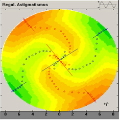 Fourier wirbelförmig