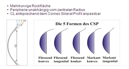 Corneo Skleral Profil