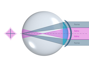 simultan abbildendes System