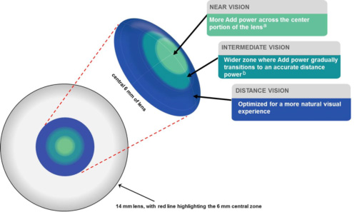 3-Zone Progressive-Design